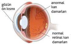 Kırmızı Göz - Göz Kanlanması - Göz Kızarıklığı